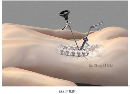 说明: 图片